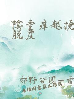 阴囊痒越挠越痒脱皮