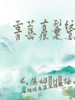 舌苔有裂纹边缘有齿痕是怎么回事