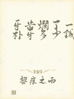 牙齿烂了一个洞补牙多少钱?