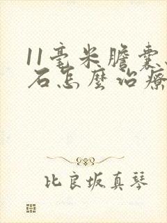 11毫米胆囊结石怎么治疗