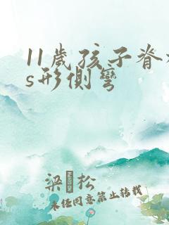 11岁孩子脊柱s形侧弯