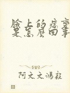 脸上的痣变多了是怎么回事