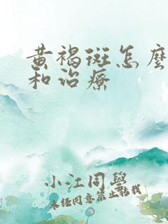 黄褐斑怎么去除和治疗