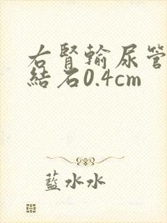 右肾输尿管下段结石0.4cm