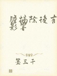 胆摘除后有什么影响