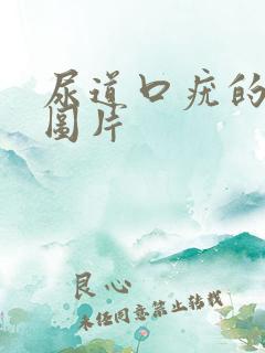 尿道口疣的症状图片