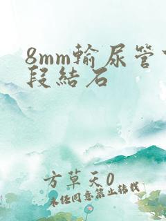 8mm输尿管下段结石