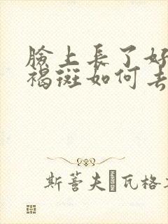 脸上长了好多黄褐斑如何去除