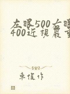 左眼500右眼400近视严重吗