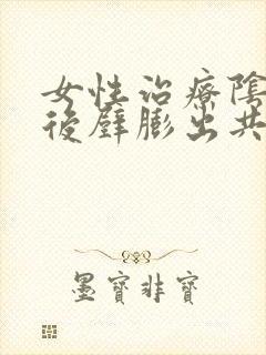 女性治疗阴道前后壁膨出共需要多少钱