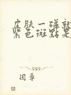 皮肤一碰就出现紫色斑点是什么原因