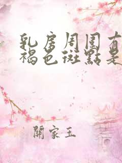 乳房周围有很多褐色斑点是怎么回事