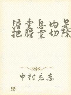 胆囊息肉是不是把胆囊切除