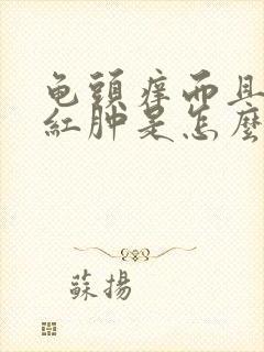 龟头痒而且包皮红肿是怎么回事