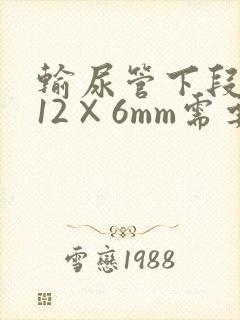 输尿管下段结石12×6mm需要手术吗
