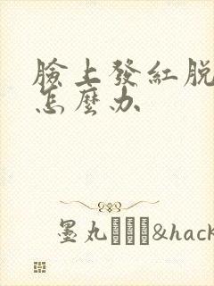 脸上发红脱皮痒怎么办