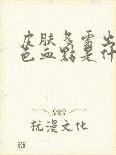 皮肤多处出现红色血点是什么原因