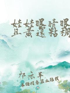 娃娃眼睛眼屎多且黄还粘稠