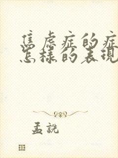 焦虑症的症状是怎样的表现