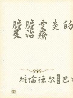 胆胆囊炎的症状及治疗