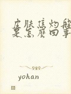 皮肤焦灼般的疼是怎么回事