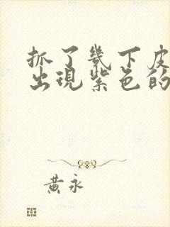 抓了几下皮肤就出现紫色的点