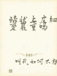 鳞状上皮细胞病变严重吗