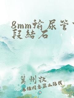 8mm输尿管下段结石