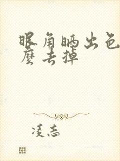 眼角晒出色斑怎么去掉