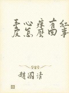 手心痒有红点脱皮怎么回事