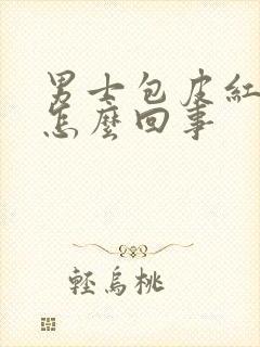 男士包皮红肿痒怎么回事