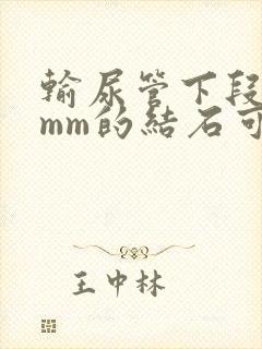 输尿管下段10mm的结石可以排出体外吗