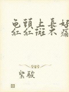 龟头上长好多小红红斑不痛不痒