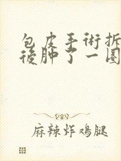 包皮手术拆纱布后肿了一圈