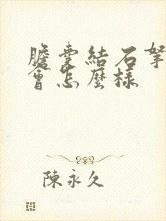 胆囊结石拿掉胆会怎么样