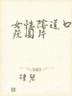 女性阴道口菜花疣图片