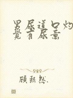 男尿道口灼热感觉有尿意