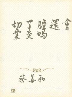 切了胆还会有胆囊炎吗