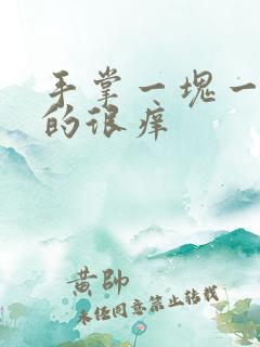 手掌一块一块红的很痒