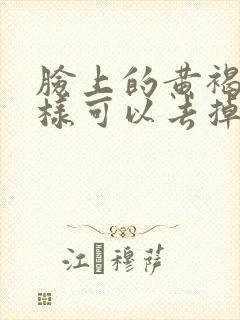 脸上的黄褐斑怎样可以去掉