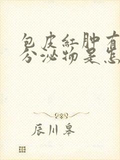 包皮红肿有白色分泌物是怎么回事