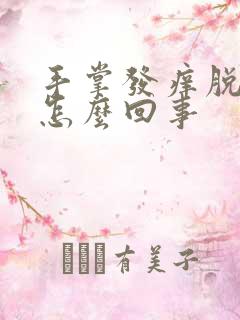 手掌发痒脱皮是怎么回事