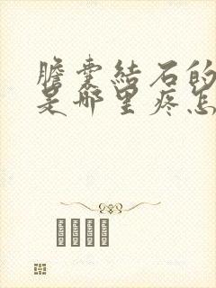 胆囊结石的症状是哪里疼怎么治疗