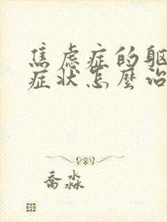 焦虑症的躯体化症状怎么治最好