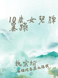 10岁女儿脾气暴躁