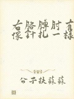 右胳膊肘有时候像针扎一样疼