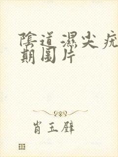 阴道湿尖疣锐初期图片