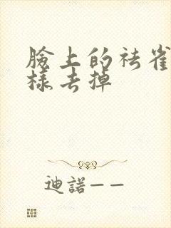 脸上的祛雀斑怎样去掉