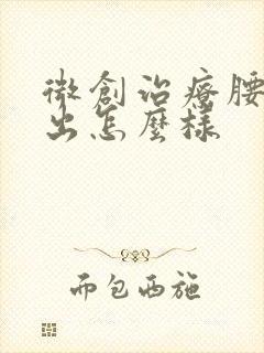 微创治疗腰椎突出怎么样