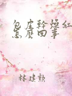 包皮干燥红肿痒怎么回事